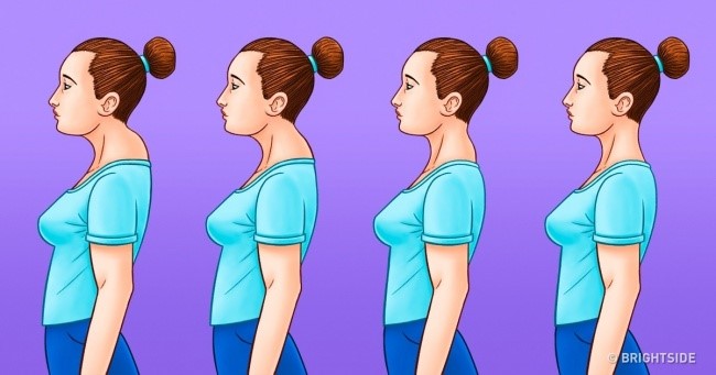 حرکات اصلاحی گردن